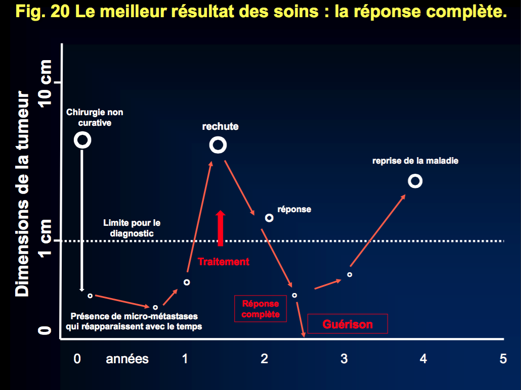 20-Le meilleur résultat des soins: la réponse complète.
