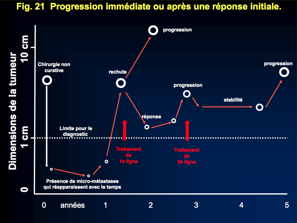 21-Progression immédiate ou après une réponse initiale.